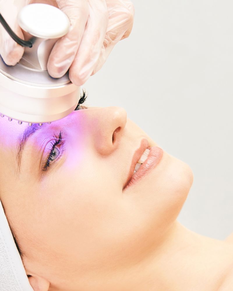 Woman getting laser treatment to face